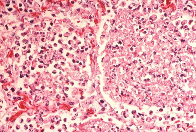legionella beheersplan belgie